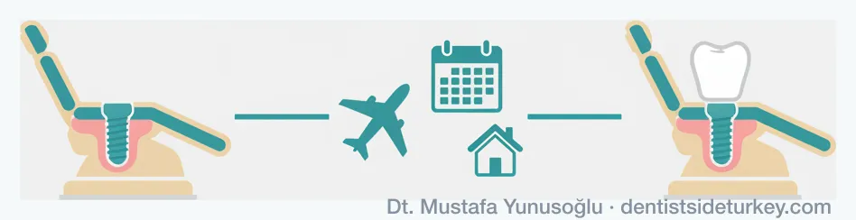 Two-visit dental treatment timeline: implant surgery in Turkey, healing at home, then a short second visit for the final crowns